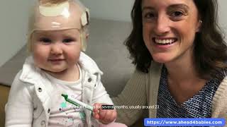 Newborn Misshapen Head Positional Plagiocephaly Treatment [upl. by Bowlds908]