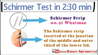 Schirmer test  Dry Eye within 230 min [upl. by Ruprecht898]