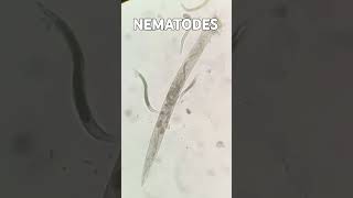 Nematodes  Agriculture  Nematology nematodes Nematology agriculture viralshort viralshorts [upl. by Aihsrop]