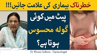 Ovarian Cancer Ki Alamaat  How To Diagnose Ovarian Cancer In UrduHindi [upl. by Chessa]