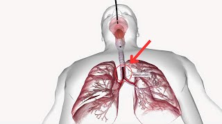 Bronchoscopy  A Peek Inside Your Lungs  Modern Medicine [upl. by Eelyme]