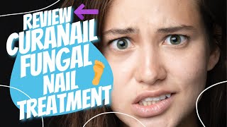 Curanail Fungal Nail Treatment  Review [upl. by Atalayah]