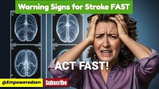 Recognize a Stroke in Seconds The LifeSaving FAST Method [upl. by Ahtelahs]