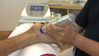 Shockwave treatment for Plantar fasciitis [upl. by Weston378]