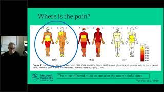 AsktheExpert Myotonic Dystrophy Type 2 amp Pain Management [upl. by Krell942]