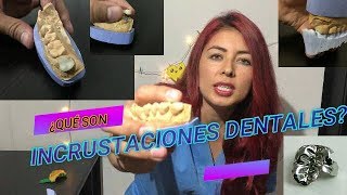 INCRUSTACIONES DENTALES QUE SON LAS INCRUSTACIONES DENTALES [upl. by Bollay]