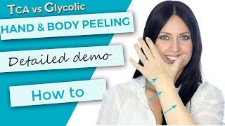 Hand and Body Peeling  Tutorial  Demonstration  TCA 30 versus Glycolic 70 [upl. by Iroj]