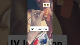 IV Insertion techniquedoctorivcannulationMedicalPracticeandTalks [upl. by Delaryd]