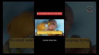 Suck Reflex in Anencephalic Babies [upl. by Oker]