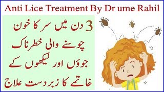 Anti lice Treatment By Dr Umme Raheel  To Get ride off from Head lice just in 3 Days  100 works [upl. by Wilhide915]