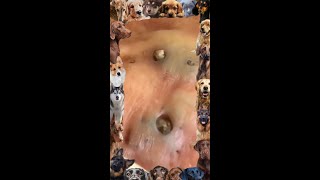 Blackhead Removal  18  Blackhead extraction  blackheads [upl. by Sisak]