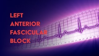 Left Anterior Fascicular Block  How to Read an Electrocardiogram EKG  MEDZCOOL [upl. by Boccaj768]