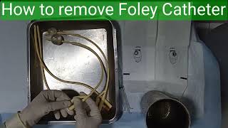 How to remove Foley Catheter [upl. by Eiramaneet]