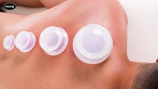 Sliding Cupping Therapy and Massage  FASCIQ® [upl. by Behnken]