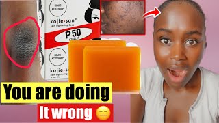 ✨HOW TO PROPERLY USE KOJIC ACID SOAP TO GET RID OF HYPERPIGMENTATION amp Dark spot [upl. by Ruscio]