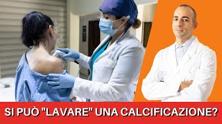 Il LAVAGGIO delle calcificazioni alla spalla LITOCLASIA è davvero utile [upl. by Uhsoj739]