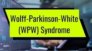 WolffParkinsonWhite WPW Syndrome [upl. by Toiboid]