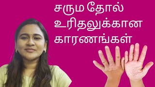 Skin Peeling தோல் உரிதல் DrGayathri Rajesh  Dermatologist  skincare  haircare [upl. by Pettiford]