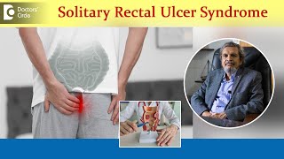 Ulcer on bottomSolitary Rectal Ulcer SyndromeCauses amp TreatmentDrRajasekhar M R Doctors Circle [upl. by Angus637]