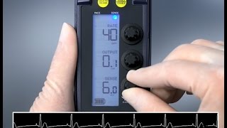 Sensing and Threshold Test — 53401 Temporary Pacemaker [upl. by Veriee190]