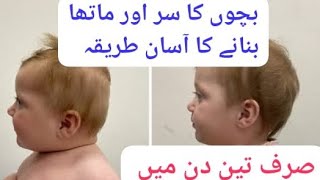 Bachon Ka Matha Or sir banany Ka Asaan Tarika  How to shape babys head and forehead [upl. by Nazario]