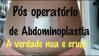 Pós operatório de Abdominoplastia lipoaspiração e enxerto de glúteo  dicas [upl. by Nnayar402]