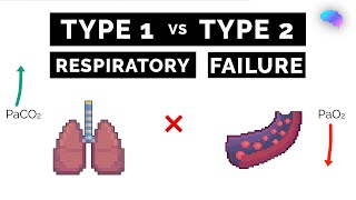 Type 1 vs Type 2 Respiratory Failure  ABG Interpretation  UKMLA  CPSA [upl. by Ahsikit503]