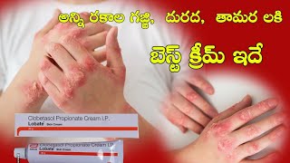 Lobate skin cream uses in telugu  best cream for skin infections  clobetasol drug uses [upl. by Sidman]