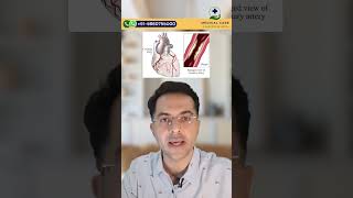 What is CABG Surgery   CABG Surgery in India [upl. by Kornher]