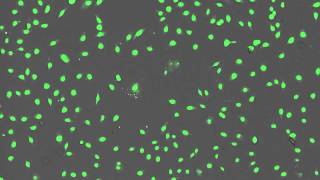 Time Lapse Imaging of BPAEC Cells Treated With Menadione [upl. by Waldon]