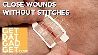 Zipstitch Closes Wounds Without Stitches [upl. by Sidonnie]