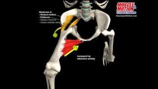 What Happens to a Knee Valgus Collapse During a Squat [upl. by Etnoek635]