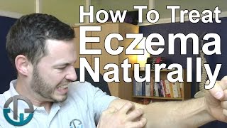 How To Treat Eczema Naturally [upl. by Vinson659]