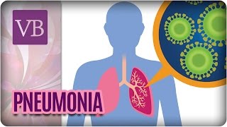 Pneumonia Causas Sintomas e Tratamentos  Você Bonita 170417 [upl. by Bannon]