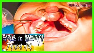 미라클 이런게 진짜 성형수술이지  응원합니다 짱짱맨  캄보디아 7일간의 기적 제1부  닥터스 응급실24 응급의학과 의사 119 구급대원 의학 다큐 다시보기 [upl. by Selinda]