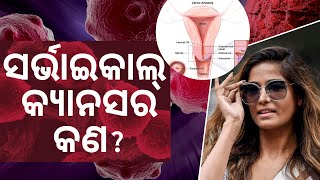 What is Cervical Cancer  Know About The Disease l Bibhuti Sir [upl. by Jeramey812]