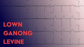 Lown Ganong Levine  ECG EKG Interpretation [upl. by Einre]