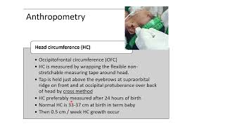 Anthropometry Measurements in Newborn  Pediatrics [upl. by Lidaa97]