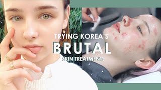 My First BRUTAL Korean Dermatology Experience 💉 BANOBAGI Laser Treatments  Sissel [upl. by Josh]