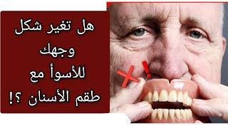 علاج مشكلة تغير شكل الوجه و الفم للأسوأ بسبب طقم الأسنان Prothèse dentaire amovible [upl. by Aniez]