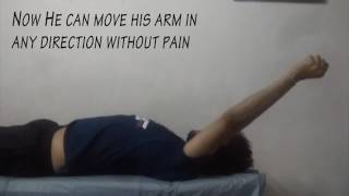 Best Physiotherapy Treatment for post Fracture Shoulder Pain [upl. by Marchak]