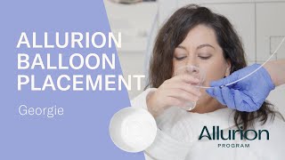 Georgies Allurion Gastric Balloon Placement [upl. by Oidualc]