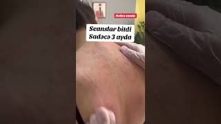 Dermatoloq dərinin dırnaqların və saçın xəstəliklərinin müalicəsi [upl. by Lief]