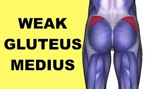 Patellar Tendonitis Exercises amp Stretches  Weak Glutes Medius amp Jumpers Knee Tendonitis [upl. by Hilaria]