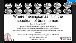 Meningioma Webinar [upl. by Aloise23]