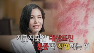 지긋지긋한 대상포진 통증과 작별하는 법  신경통  명의  EBS건강 [upl. by Clea]