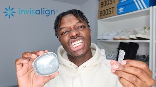 LIFE AFTER INVISALIGN  PERMANENT VS NIGHT TIME RETAINER  MARLON T [upl. by Clova]