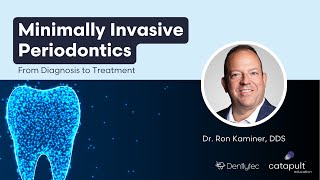 Dental Treatment Minimally Invasive Periodontics  Oct 30 2023 [upl. by Aikram]