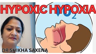 Hypoxic hypoxia Types of hypoxia Telegram httpstmedrshikhasaxenahumanphysio [upl. by Neellek]