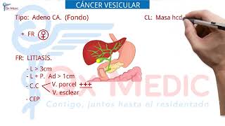 Cirugía general  09 Neoplasias gastrointestinales [upl. by Hsak]